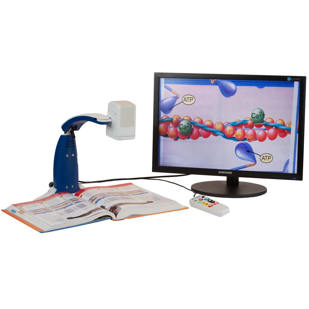 Универсальный видеоувеличитель ONYX Portable HD